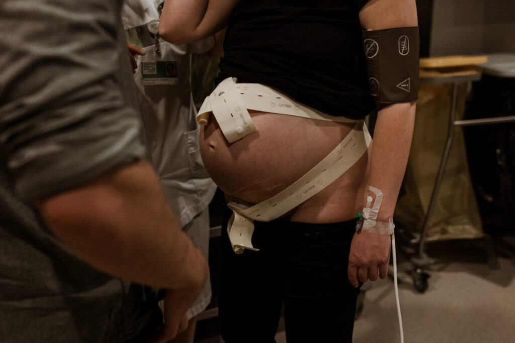 Baring Tim Willemsen epiduraal