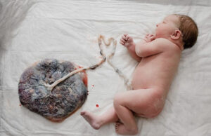 Wanneer is een bevalling traumatisch voor de baby?