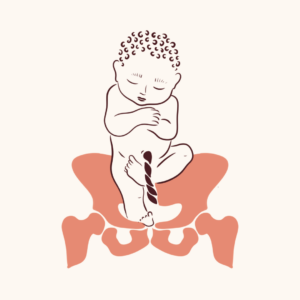 Stuitligging baby bekken